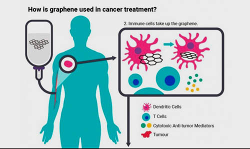 Illustration of how graphene is used to treat cancer